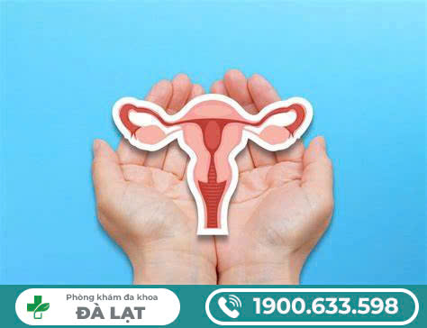 Hình ảnh minh họa